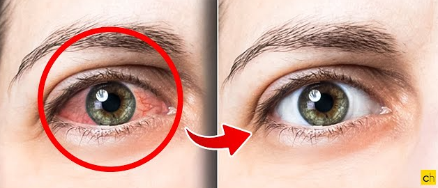 Comparação de olhos antes e depois do tratamento